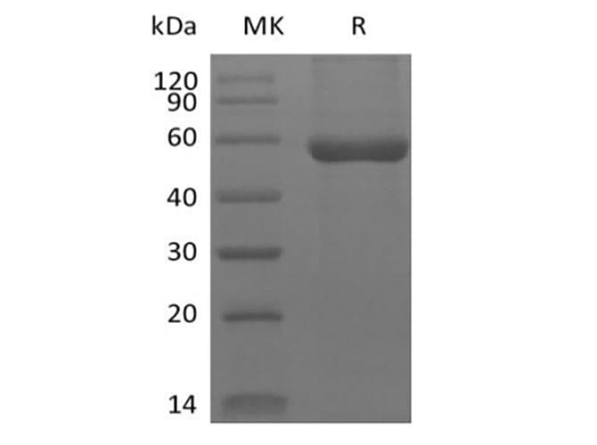 Human Hla-dqa1 gene (dqa1*0201, dqa1*03011 and dqa1*0303) Protein (Recombinant 10His, C-terminus)
