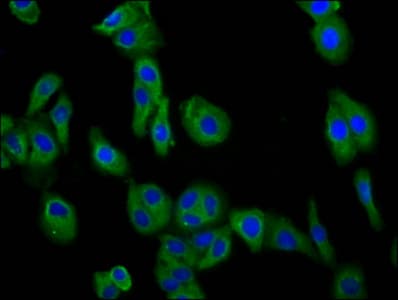 TM7SF4 / DC-STAMP Antibody