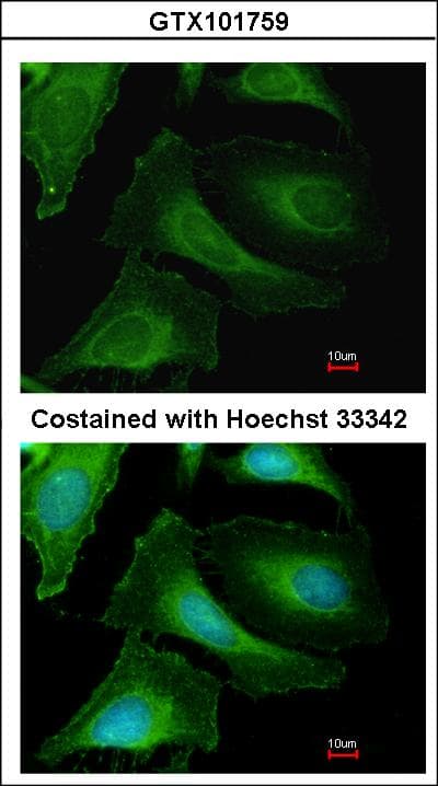 CKB / Creatine Kinase BB Antibody