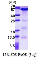 Human EED Protein (Recombinant His)