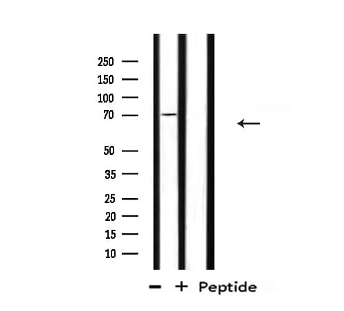 Polyclonal Rabbit anti-Human SAE2 / UBA2 Antibody (IHC, IF, WB)