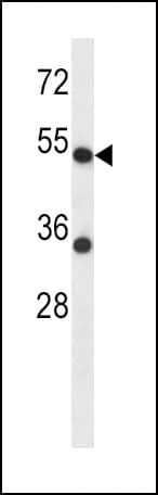 Polyclonal Rabbit anti-Human ADRA2C Antibody (aa354-382, IHC, WB)