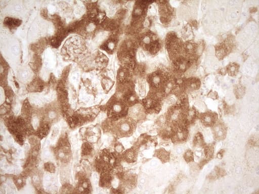 PROZ / Protein Z Antibody (aa115-400, clone OTI4F1)