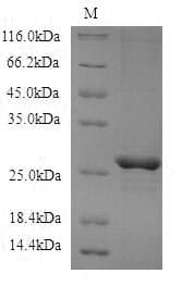 Mouse CBLN3 / Cerebellin 3 Protein (Recombinant 6His-SUMO, N-terminus)