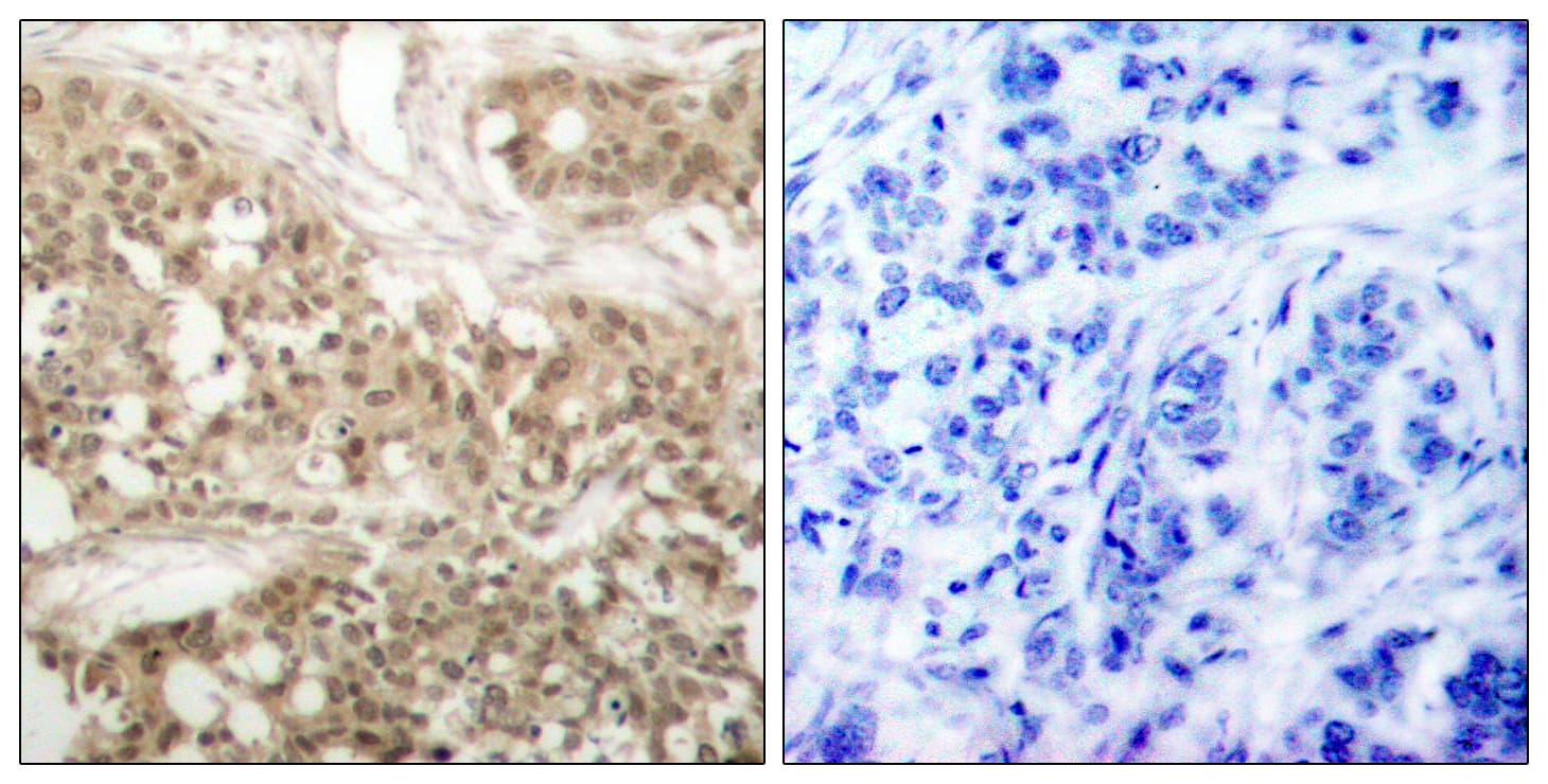 PRKCQ / PKC-Theta Antibody (phospho-Ser676)