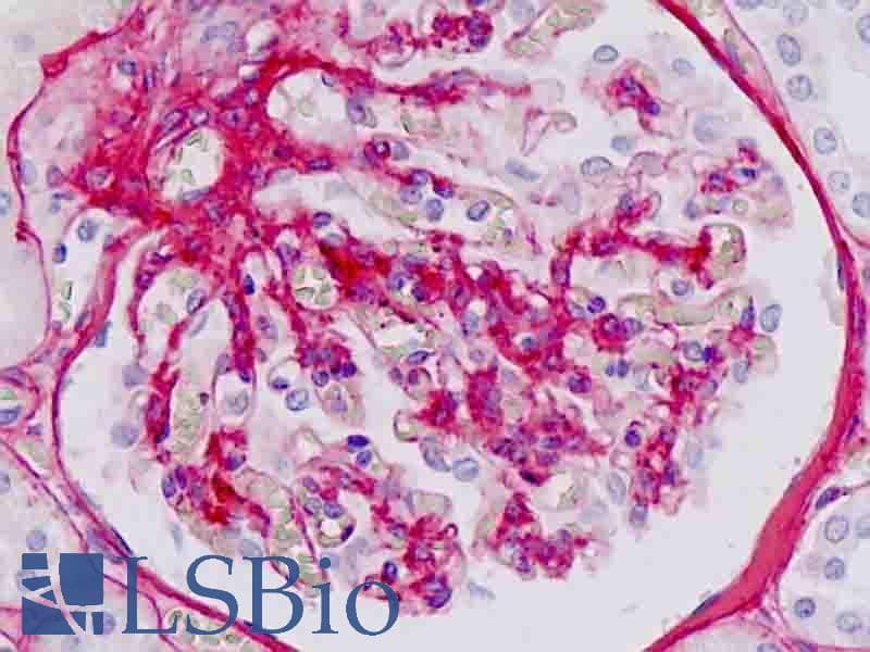 PathPlus™ Collagen IV Antibody