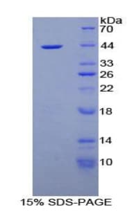 Mouse Nesfatin-1 Protein (Recombinant His-GST)