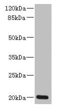 Polyclonal Rabbit anti-Human ZMAT5 Antibody (aa1-170)