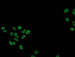 TP53 / p53 Antibody (clone OTI3A6)