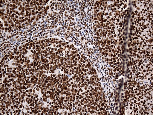 HNRNPH1 / hnRNP H Antibody (clone OTI5D11)