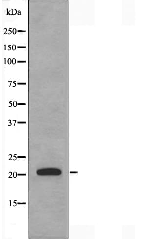 DUSP22 / JSP 1 Antibody