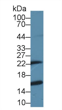 GSTP1 / GST Pi Antibody (aa1-210, PE)