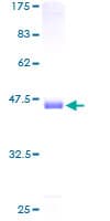 Human CFL1 / Cofilin Protein (Recombinant GST)