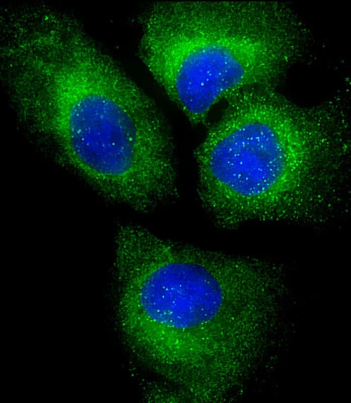 PLIN3 / M6PRBP1 / TIP47 Antibody (clone 1651CT157.85.94)