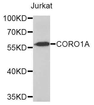 CORO1A / Coronin 1a Antibody