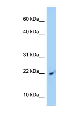 SRP14 Antibody (aa81-130)