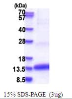 Human CLPS / Colipase Protein (Recombinant His)