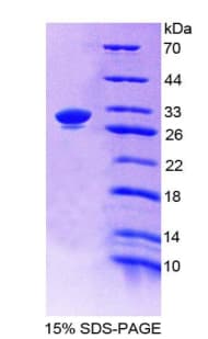 Chicken Complement C4 Protein (Recombinant His-T7)
