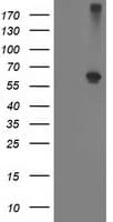 ADH2 / ADH1B Antibody (clone OTI3F2)