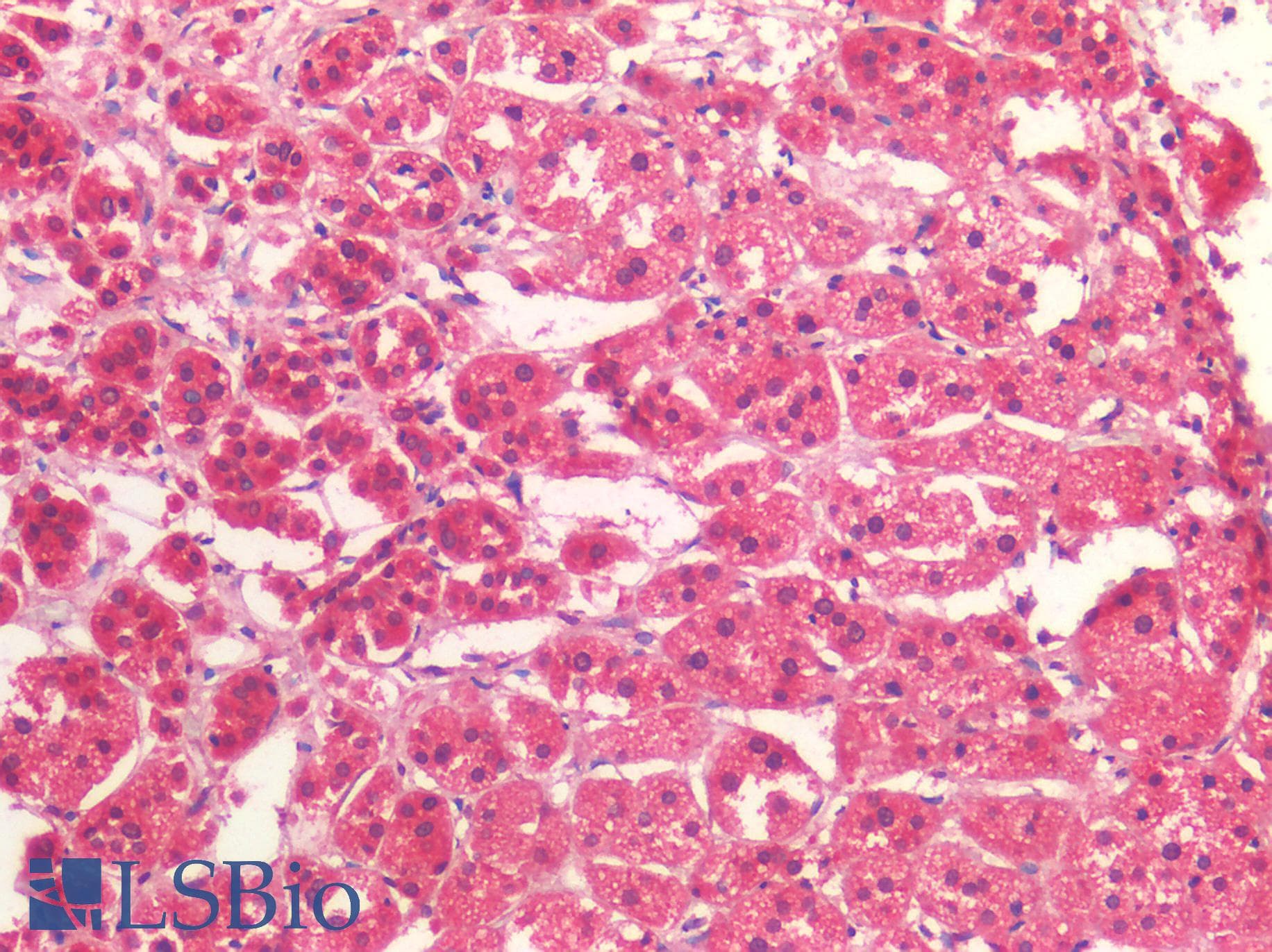 IHC-plus™ Polyclonal Rabbit anti-Human CKAP5 / ch-TOG Antibody (IHC, IF, WB)