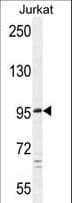 PTCHD4 / C6orf138 Antibody (aa563-591)