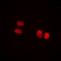 IHC-plus™ Treacle / TCOF1 Antibody (N-Terminus)