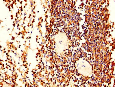 Polyclonal Rabbit anti-Human LCP1 / L-Plastin Antibody (aa2-627, IHC, WB)