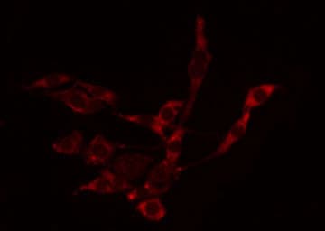 PAK5 + PAK6 Antibody
