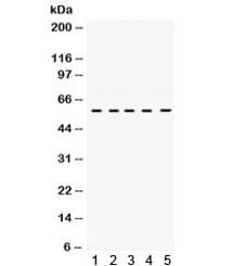 Polyclonal Rabbit anti-Human p56lck / LCK Antibody (IHC, WB)