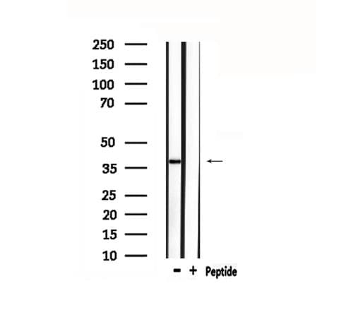 Polyclonal Rabbit anti-Human LPAR3 / LPA3 / EDG7 Antibody (IF, WB)