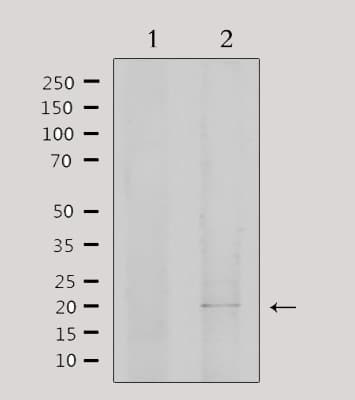 EID1 / EID-1 Antibody