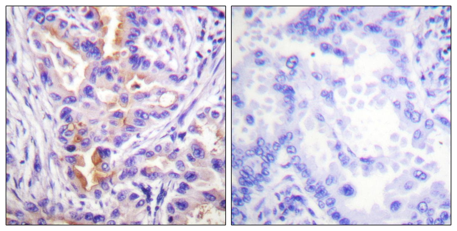 PRKCQ / PKC-Theta Antibody (p538)