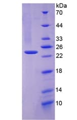 Rat PLAT / TPA Protein (Recombinant His-T7)