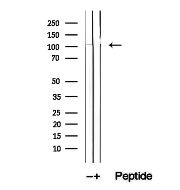 DIS3 Antibody