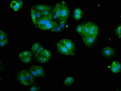 Polyclonal Rabbit anti-Human CSTA / Cystatin A Antibody