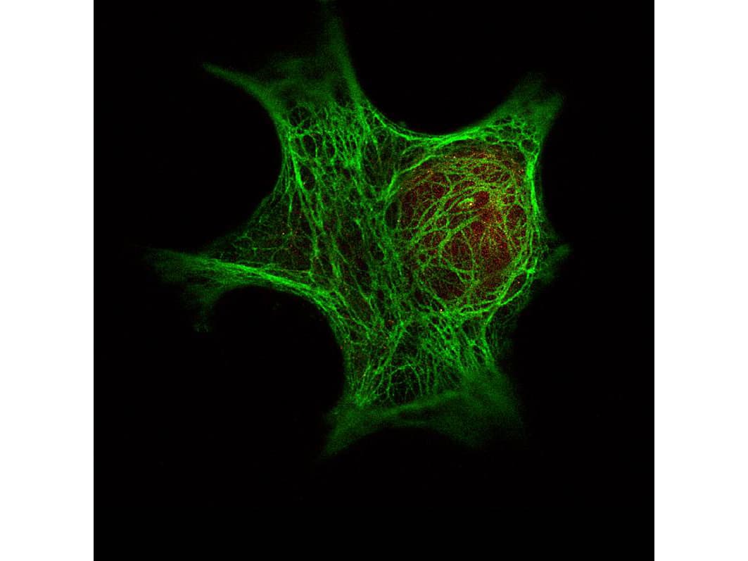 PathPlus™ Pan Cytokeratin Antibody (clone C11)