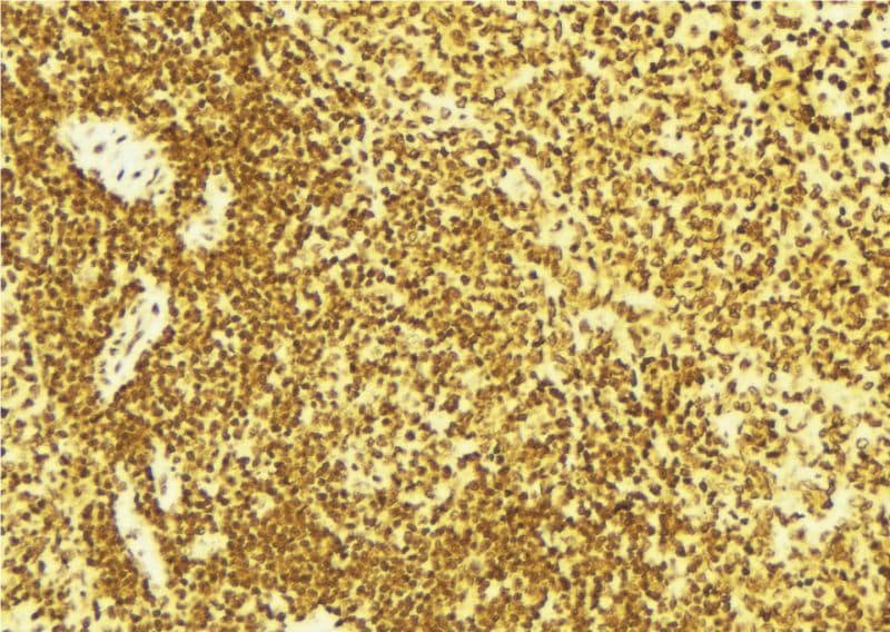 EIF2AK2 / PKR Antibody