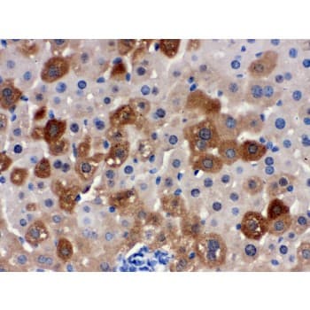 Polyclonal Rabbit anti-Human SULT2A1 / Sulfotransferase 2A1 Antibody (aa253-285, IHC, WB)