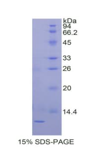Horse TIMP2 Protein (Recombinant His)