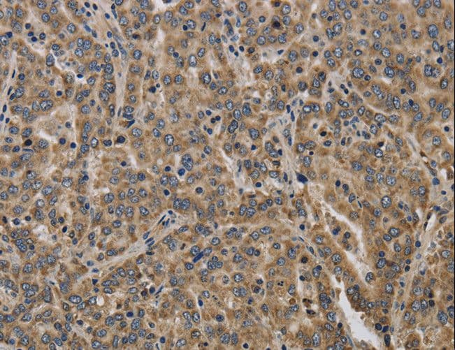 KCNMB2 Antibody