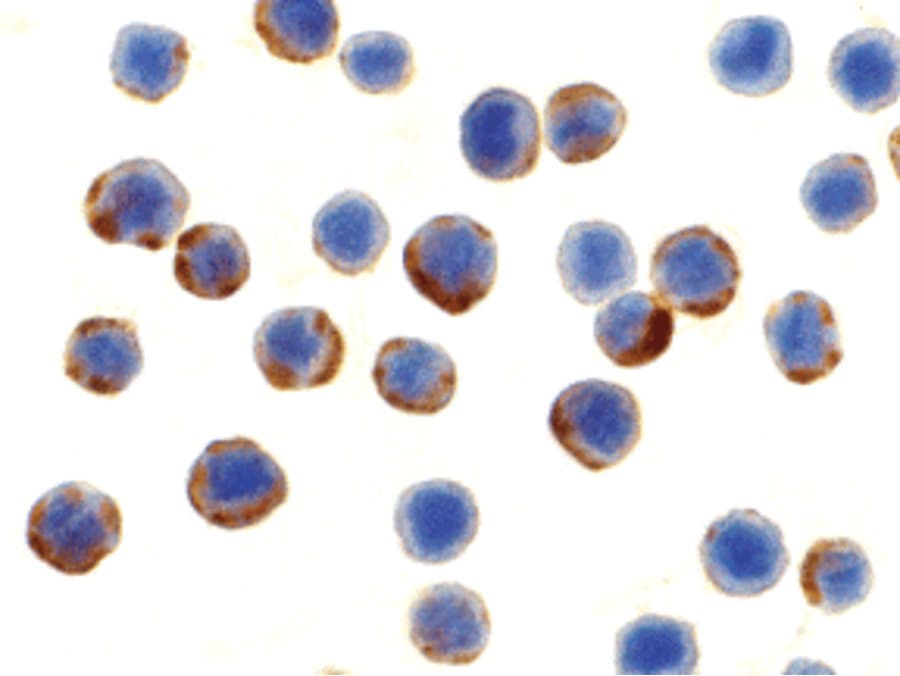 IHC-plus™ Polyclonal Rabbit anti-Human Apg7 / ATG7 Antibody (IHC, IF, WB)