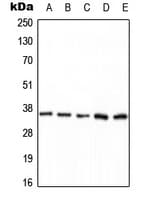 Polyclonal Rabbit anti-Human PP2Ac / PPP2CA Antibody (phospho-Tyr307, WB)
