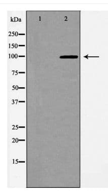 Polyclonal Rabbit anti-Human EPHA2 / EPH Receptor A2 Antibody (WB)