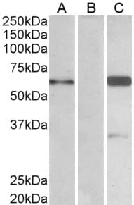 IHC-plus™ BAIAP2 / IRSP53 Antibody (Isoform 3)