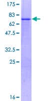 Human ZNF643 Protein (Recombinant GST)