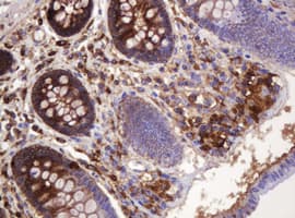 ATP6V1B2 Antibody (clone 1.00E+11, Carrier-free)