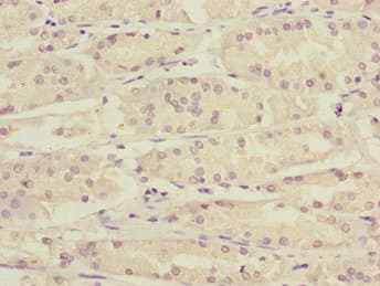 Polyclonal Rabbit anti-Human KLF15 Antibody (IHC)