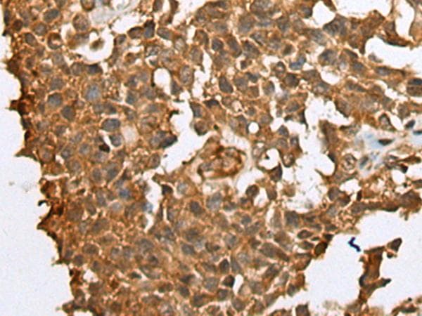 Polyclonal Rabbit anti-Human YBX1 / YB1 Antibody (IHC)