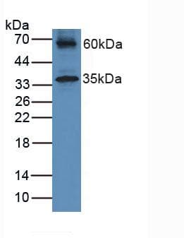 HFE2 / Hemojuvelin Antibody (aa41-386)