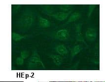 PIK3R1 / p85 Alpha Antibody (clone AB6)